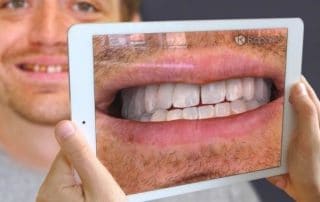 آینه مجازی دندانپزشکی - آینه واقعیت مجازی - دیدن دندان های اصلاح شده قبل از جراحی