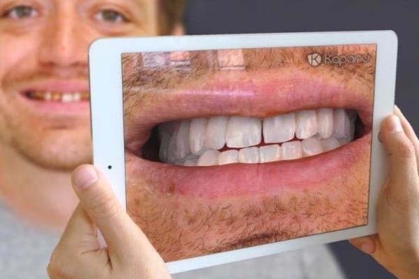 آینه مجازی دندانپزشکی - آینه واقعیت مجازی - دیدن دندان های اصلاح شده قبل از جراحی